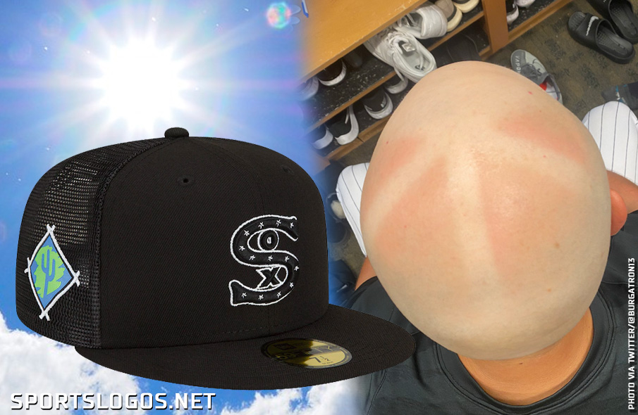 Baseball's New Mesh Cap Results in Sunburn for ChiSox Player